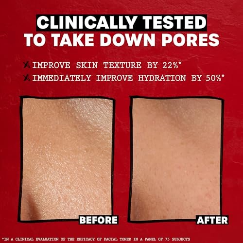 THAYERS Alcohol-Free Rose Petal Witch Hazel Facial... - Image 5