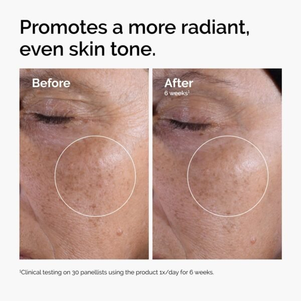 The Ordinary Glycolic Acid 7% Exfoliating Toner, B... - Image 3