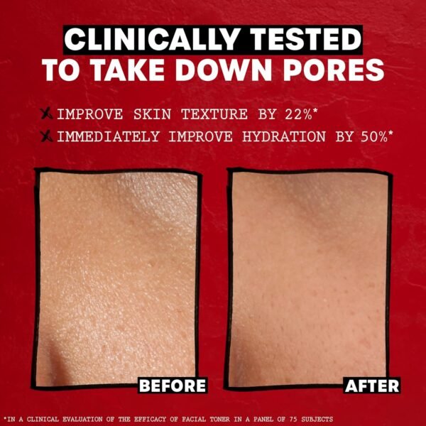 THAYERS Alcohol-Free, Hydrating, Unscented Witch H... - Image 5