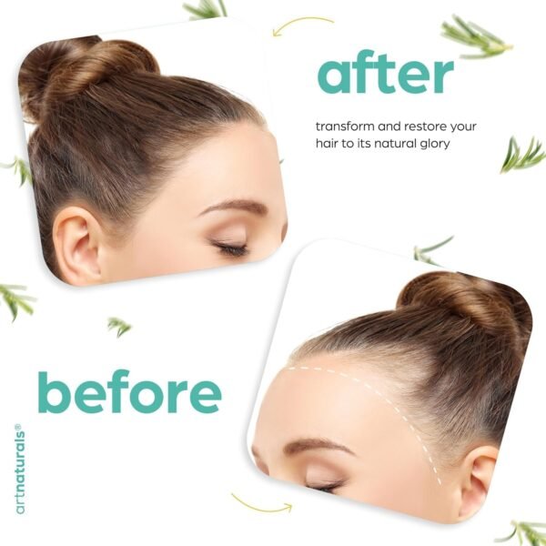 ArtNaturals Organic Rosemary & Castor Hair Growth ... - Image 7