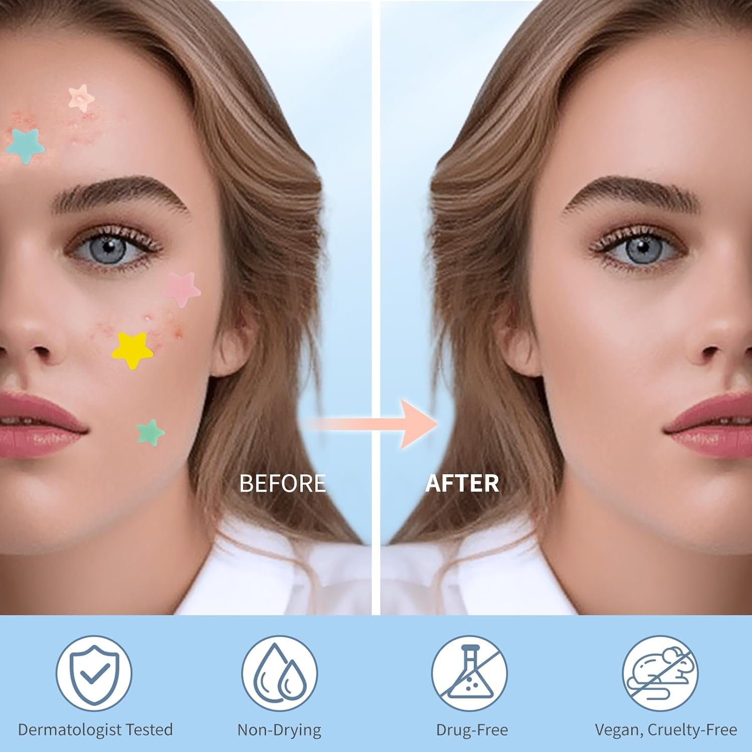 QUSTERE Pimple Patches for Face, Hydrocolloid Acne... - Image 5